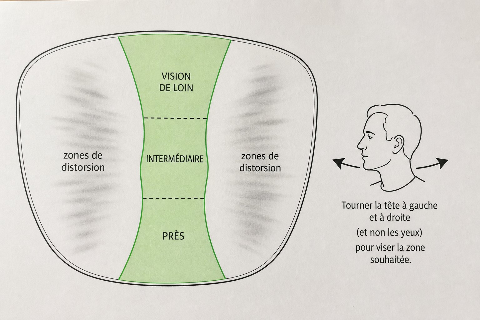 Diagramme d'un verre progressif montrant le couloir de vision nette et les zones de distorsion latérales